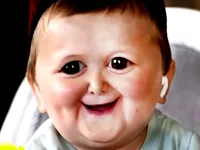 image Funny Hasbulla Face